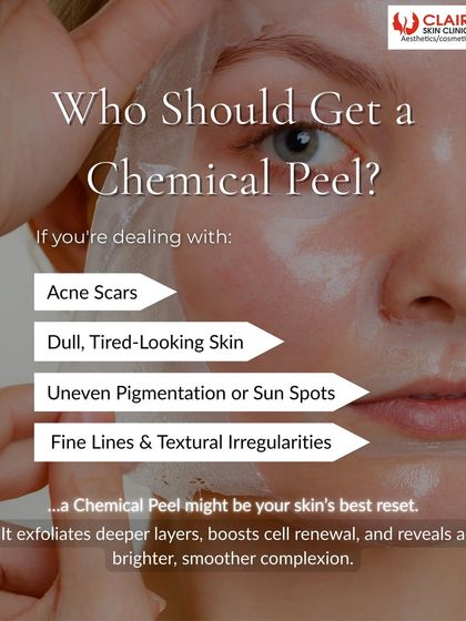 Wondering if a chemical peel is for you? If you're dealing with acne scars, dull skin, or uneven pigmentation, it might be your skin's best reset.