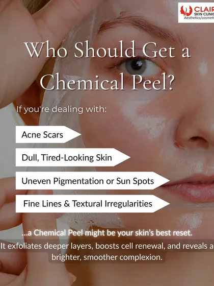 Wondering if a chemical peel is for you? If you're dealing with acne scars, dull skin, or uneven pigmentation, it might be your skin's best reset.