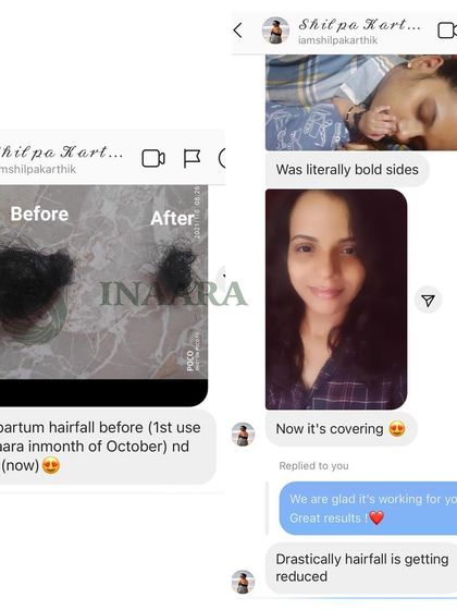 A side-by-side comparison showing the reduction in postpartum hair fall. You can see the large amount of hair lost before, compared to the minimal shedding after starting her Inaara routine.