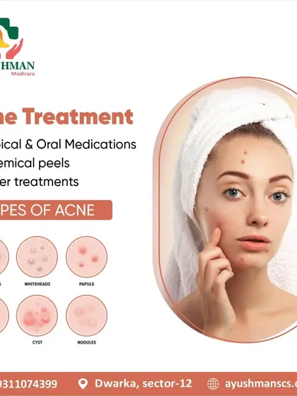 This graphic explains the different types of acne I treat, from blackheads to cysts. My methods include topical medications, chemical peels, and laser treatments tailored to your specific condition.