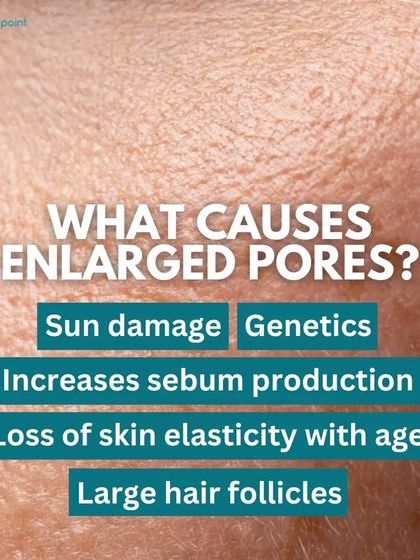 Enlarged pores can be caused by genetics, sun damage, and loss of skin elasticity. Understanding the cause helps us choose the right treatment for you.