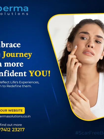 Scars from acne, trauma, or surgery can affect your confidence. My aim is to use advanced dermatological procedures to redefine these marks and help you embrace your skin's story.