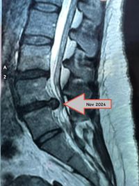 Orthopaedic Physiotherapy & Pain Management