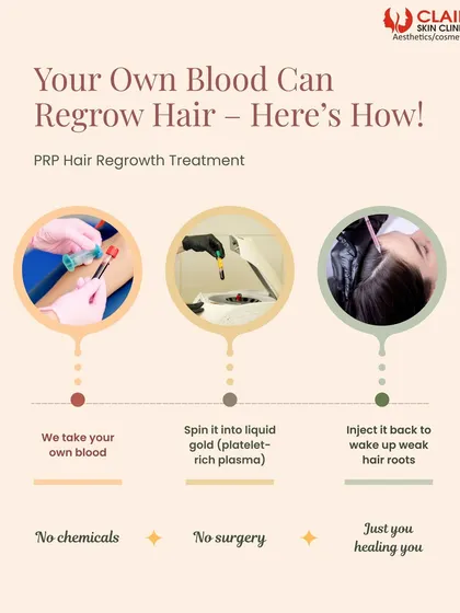 We believe in using your body's natural healing power. This graphic simplifies our PRP hair regrowth process into three steps: drawing a small amount of your blood, concentrating the platelets, and injecting the plasma to rejuvenate hair roots.