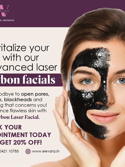 This graphic highlights the benefits of my advanced laser Carbon Facial. It's an excellent solution for open pores, oily skin, and blackheads, helping you achieve flawless skin.