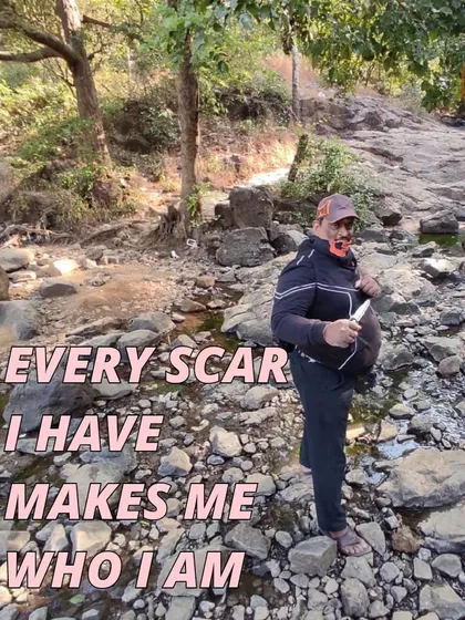 Every scar makes me who I am. This was taken during a one-day ride and train event with my warrior tribe at Tungareshwar.