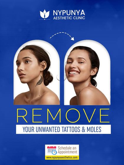 Ready for a clean slate? We offer advanced, safe, and effective laser treatments for the removal of unwanted tattoos and moles, allowing you to move forward with clear skin.