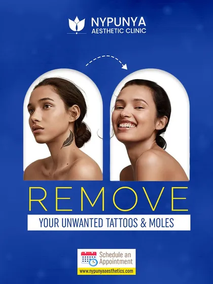 Are you ready for a clean slate? I offer advanced laser treatments for the removal of unwanted tattoos and moles, helping you move forward with clear, unblemished skin.