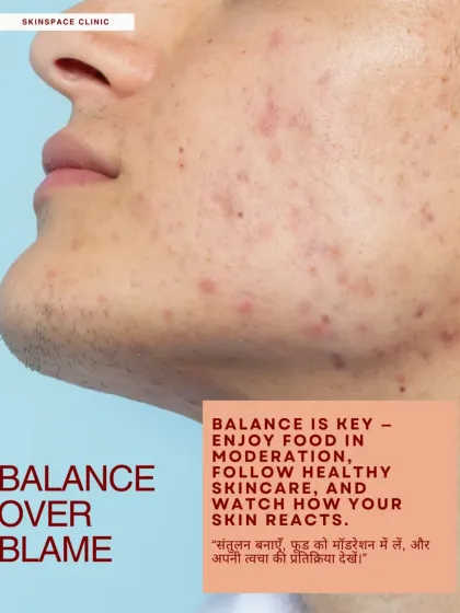 The key is balance over blame. We encourage enjoying food in moderation, following a healthy skincare routine prescribed by a dermatologist, and observing how your skin reacts to different lifestyle factors.