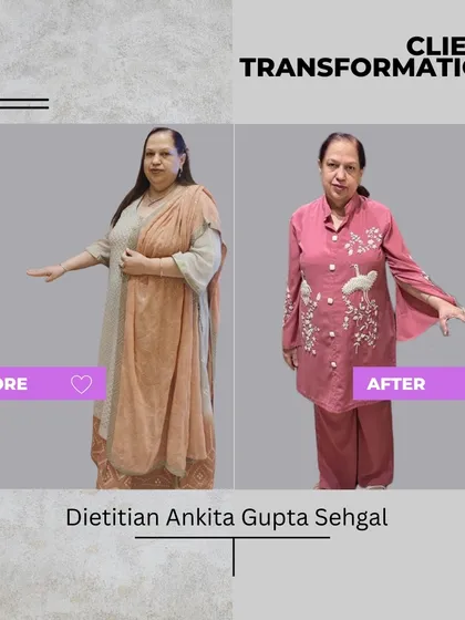 Rakhi Gulati's 14 kg weight loss in 6 months is a life-transforming story. She got rid of knee pain and fatigue, and is now able to live her life to the fullest with more energy than ever before.