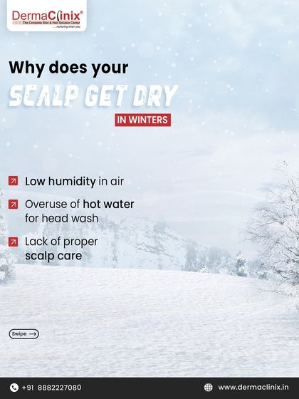 Why does your scalp get dry in winter? It's a combination of low humidity in the air, overuse of hot water for washing, and a lack of proper scalp care.