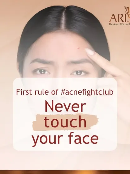 The first and most important rule of managing acne is to avoid touching your face. This prevents the spread of bacteria and reduces the risk of inflammation and scarring.