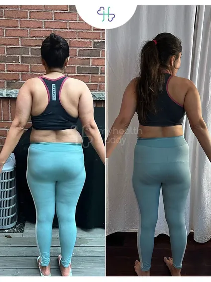 Back view of Ruchika's 10kg loss, showing a more defined and stronger back.