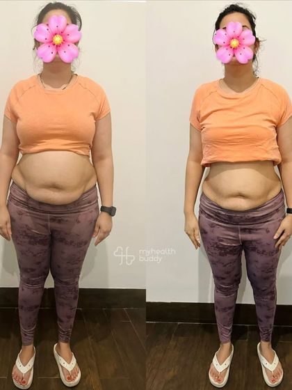 A side, back, and front view of a working mom's incredible postpartum progress. She stayed consistent with home workouts and never used her busy schedule as an excuse, reclaiming her confidence and strength.