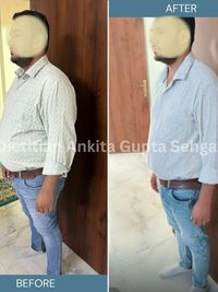 Weight Management Programs