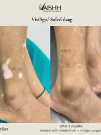 Medical & Surgical Dermatology