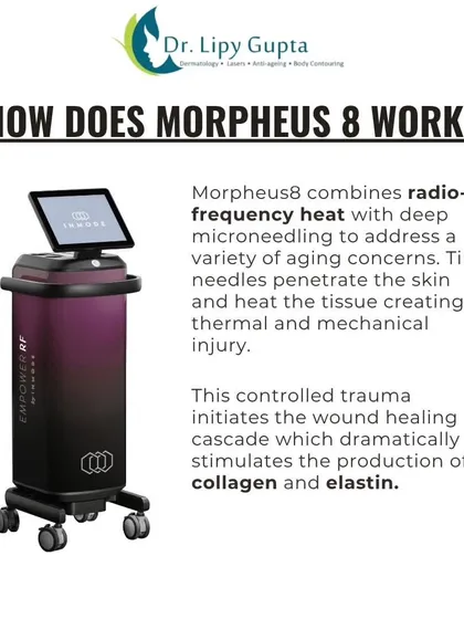 Here I explain the science behind Morpheus8. The combination of radiofrequency heat and deep microneedling creates a controlled thermal effect that triggers the body's natural healing process, dramatically boosting collagen and elastin.