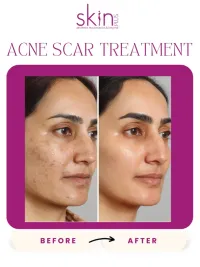 Advanced Skin Correction