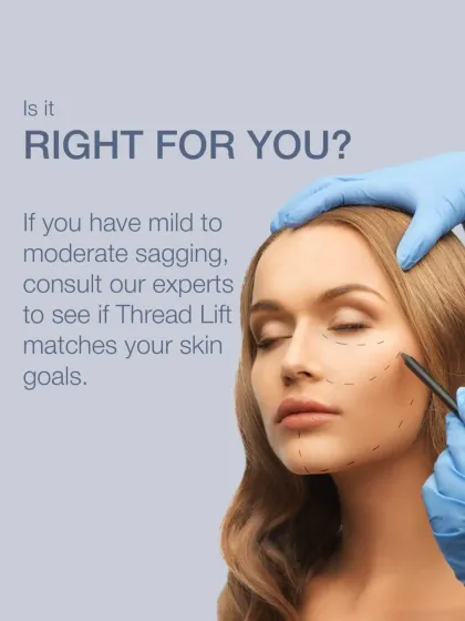 Is a thread lift right for you? This treatment is ideal if you have mild to moderate sagging. I always conduct a thorough consultation to ensure it aligns with your skin goals.