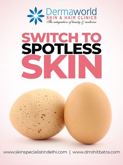 It's time to switch from spotted, uneven skin to a smooth, clear complexion. With the right treatments, you can achieve the spotless skin you've been wanting.