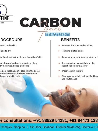 This graphic explains the procedure and benefits of our Carbon Facial Treatment. It details how the carbon attaches to dirt and bacteria, which is then vaporized by the laser to stimulate collagen and clear pores.