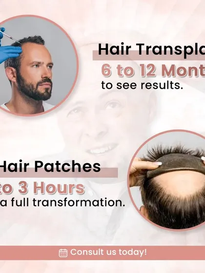 This graphic compares the timelines. A hair transplant can take 6 to 12 months to show full results, while our non-surgical hair patches provide a complete transformation in just 2 to 3 hours.