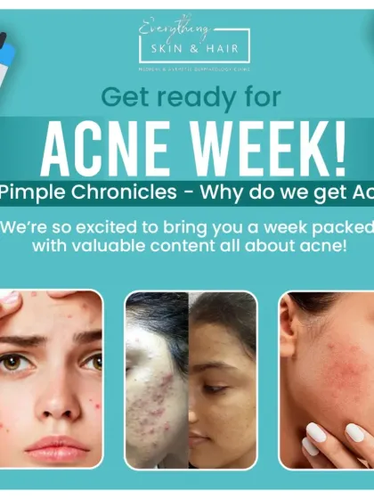 Acne is one of the most common skin concerns I see. This post announces our "Acne Week," where we share valuable, evidence-based information to help you understand and manage your skin.