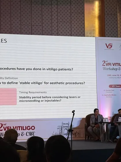 Here I am serving as a panelist for the Vitiligo Foundation of India. We discussed the careful considerations for performing aesthetic procedures like laser hair removal on patients with vitiligo. This highlights my focus on medical dermatology, ensuring every procedure is conducted with the utmost safety and patient care in mind.