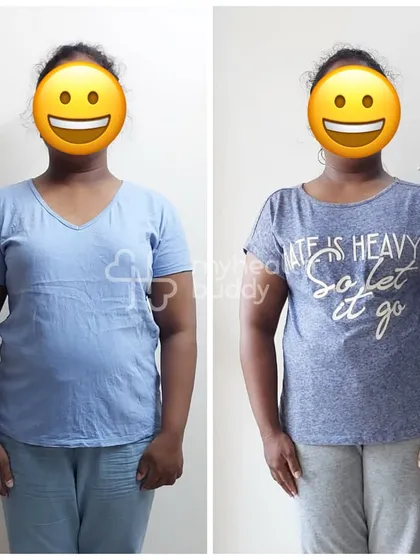 Another angle of the client who lost 5 kgs in 3 months. Consistency with the basics is what drives these incredible changes.