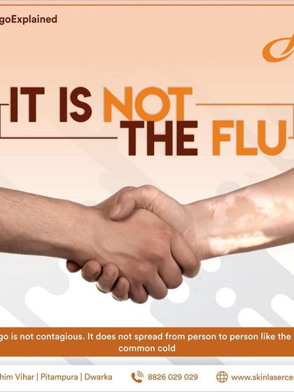 Vitiligo does not spread from person to person like the flu or a common cold. Knowing and sharing this fact helps end the social stigma that many people with vitiligo face.