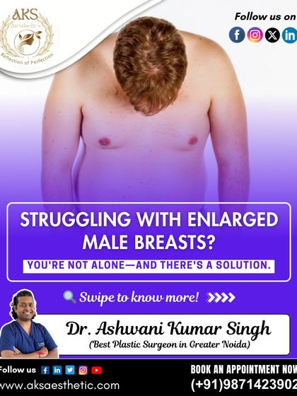 If you are struggling with enlarged male breasts, please know that you are not alone and there is a solution. This series explains the signs of gynecomastia.