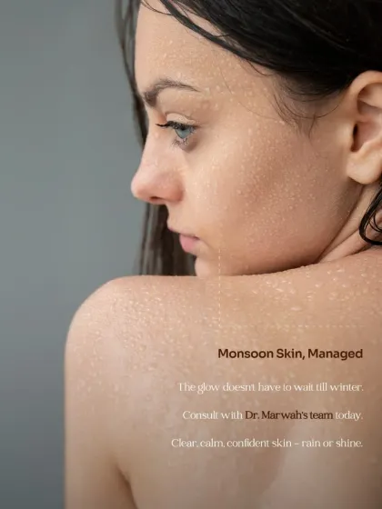 The monsoon season can be harsh on your skin, but your glow doesn't have to wait for winter. We provide scientifically backed and clinically delivered treatments to manage monsoon skin issues, ensuring your skin stays clear, calm, and confident.