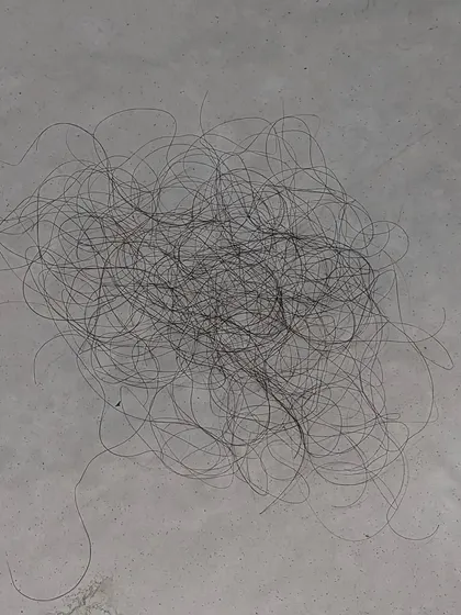 This is another visual of 100 shed hairs on a flat surface. Don't waste time on ineffective remedies if you are losing more than this; a proper diagnosis is key to an effective treatment plan.