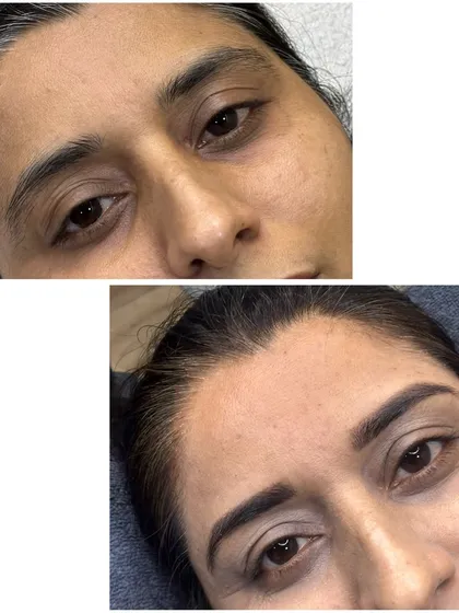 If you love a soft, powdered makeup look, ombre brows are for you. See how this transformation gives the brows a beautiful, defined shape without any harsh lines, just a gentle gradient of color.