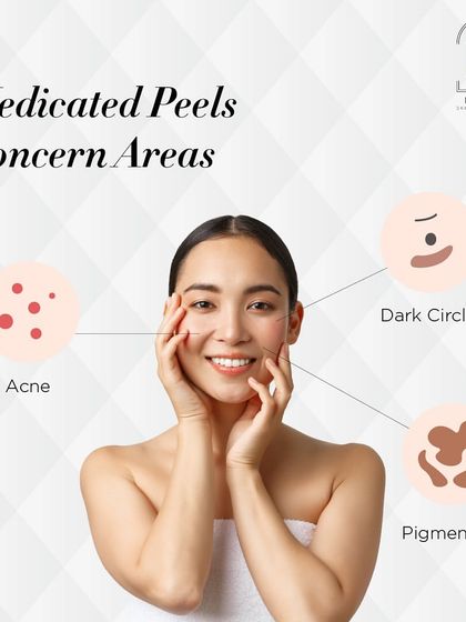 Medicated peels are excellent for addressing specific concern areas like acne, dark circles, and pigmentation.