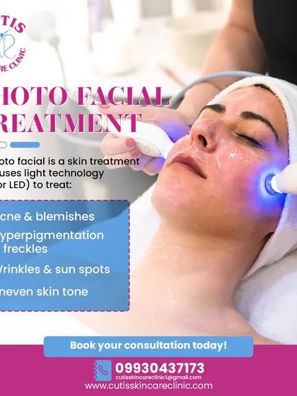 Here you can see a client undergoing a Photo Facial treatment, which uses IPL or LED light technology. This non-invasive procedure is excellent for targeting specific concerns like acne, pigmentation, sun spots, and redness, promoting a clearer and more even complexion.