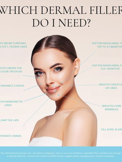 A detailed guide on the different applications of dermal fillers. I use them to address a wide range of concerns, including smoothing under-eye troughs, enhancing cheeks, and filling acne scars for comprehensive facial rejuvenation.