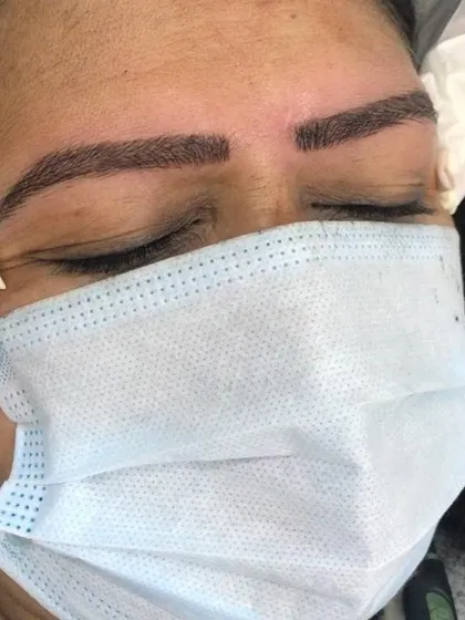 Here is the final result of our eyebrow microblading service. Notice the clean, natural-looking hair strokes that create a fuller, perfectly defined brow shape, eliminating any patchiness for a polished look.