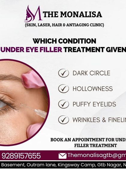 Under-eye filler treatment is an excellent solution for several concerns. We use it to address dark circles, hollowness, puffy eyelids, and fine lines, restoring a refreshed and youthful appearance to the eye area.