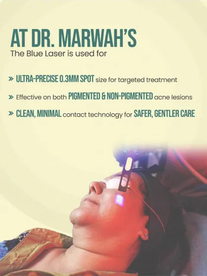 Our Blue Laser for acne is designed for ultra-precise treatment, using a 0.3mm spot size to target both pigmented and non-pigmented lesions. This minimal contact technology ensures a safer, gentler, and more hygienic treatment experience.