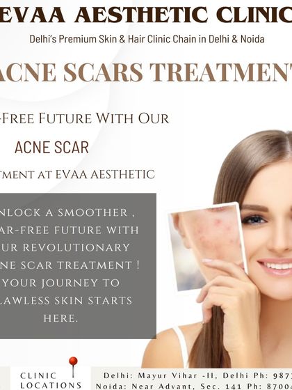 Unlock a scar-free future with our revolutionary acne scar treatments. This visual emphasizes our commitment to helping you achieve flawless skin.