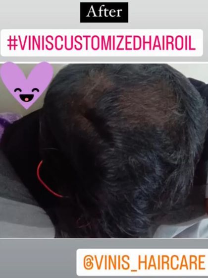 The corresponding 'after' photo for the same customer. Consistent application of natural oils nourishes the scalp and supports healthier hair.