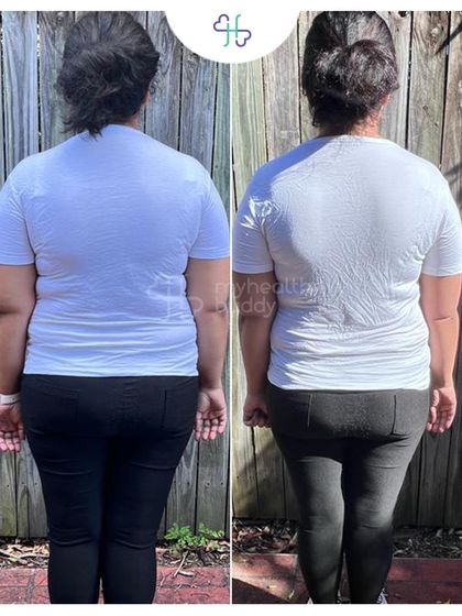 Arpit lost 10 kgs in 6 months. Her journey shows that even with a long road ahead, the first few months of progress can be remarkable.