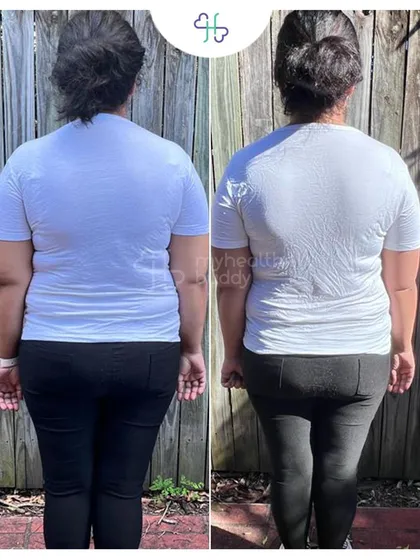 Arpit lost 10 kgs in 6 months. Her journey shows that even with a long road ahead, the first few months of progress can be remarkable.