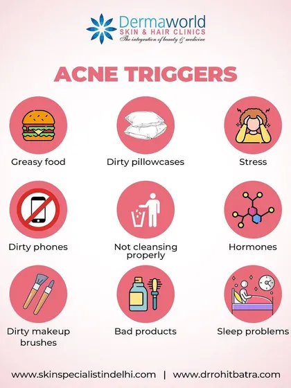 Many daily habits can trigger or worsen acne. This visual guide points out common culprits, including greasy foods, stress, hormonal fluctuations, and even a dirty phone screen. Identifying your personal triggers is a key part of managing your skin.