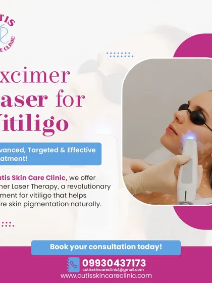 We use advanced technology like the Excimer Laser for targeted vitiligo treatment. This procedure safely stimulates repigmentation in affected areas, offering an effective, non-invasive solution for restoring your skin's natural color.
