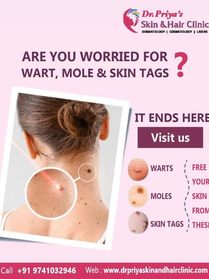 Priya J Talageri - Laser Tattoo & Blemish Removal Blemish, Mole, and Tag Removal photo 3