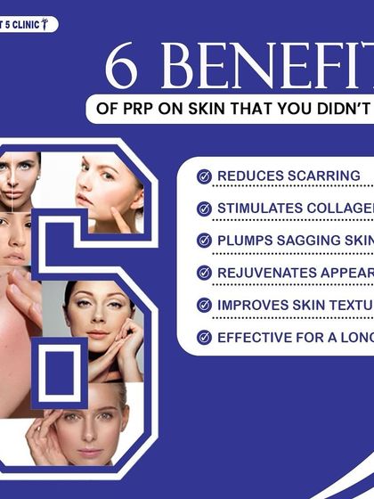 This graphic outlines six key benefits of PRP for the skin, including reducing scarring, stimulating collagen, plumping sagging skin, and improving overall skin texture for long-lasting results.