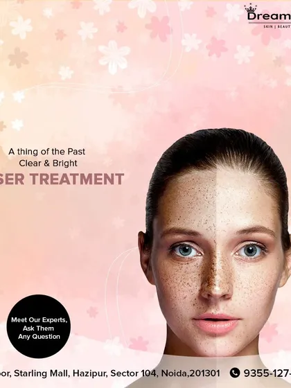 Our clear and bright laser treatments make pigmentation a thing of the past. We use advanced laser technology to break down excess pigment in the skin, revealing a more even and luminous skin tone.