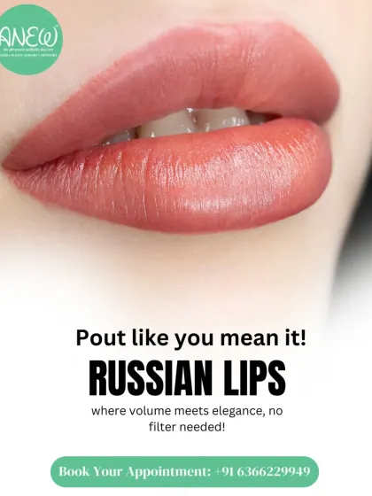 The Russian Lips technique is where volume meets elegance. It is designed to create a heart-shaped pout with more height and less projection, avoiding an overfilled look.